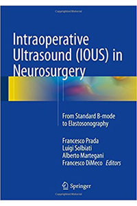copertina di Intraoperative Ultrasound ( IOUS ) in Neurosurgery - From Standard B - mode to Elastosonography