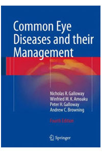 copertina di Common Eye Diseases and their Management