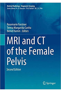 copertina di MRI ( Magnetic resonance imaging ) and CT (Computed Tomography)  of the Female Pelvis