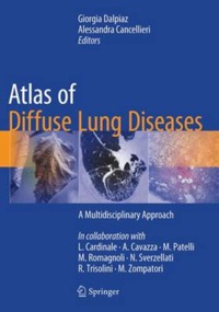 copertina di Atlas of Diffuse Lung Diseases - A Multidisciplinary Approach