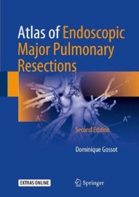 copertina di Atlas of endoscopic major pulmonary resections