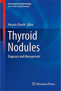 copertina di Thyroid Nodules: Diagnosis and Management