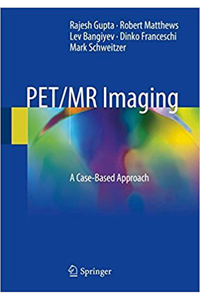 copertina di Pet ( Positron Emission Tomography)  / MR ( Magnetic Resonance ) Imaging: A Case ...