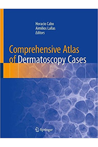 copertina di Comprehensive Atlas of Dermatoscopy Cases