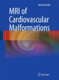 copertina di MRI ( Magnetic resonance imaging ) of Cardiovascular Malformations