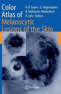 copertina di Color Atlas of Melanocytic Lesions of the Skin