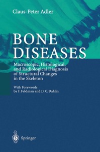 copertina di Bone Diseases: Macroscopic, Histological, and Radiological Diagnosis of Structural ...