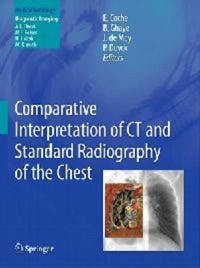 copertina di Comparative Interpretation of CT ( Computed Tomography ) and Standard Radiography ...