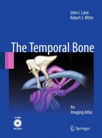 copertina di Temporal Bone - An Imaging Atlas - CD - Rom included