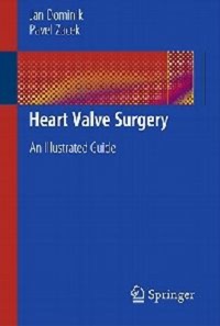 copertina di Heart Valve Surgery - An Illustrated Guide