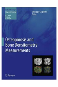 copertina di Osteoporosis and Bone Densitometry Measurements