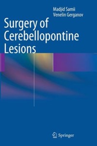 copertina di Surgery of Cerebellopontine Lesions