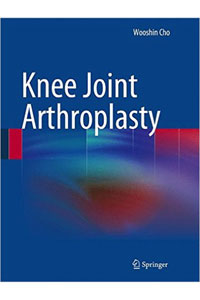 copertina di Knee Joint Arthroplasty