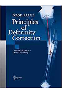 copertina di Principles of Deformity Correction