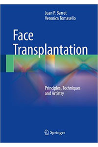 copertina di Face Transplantation - Principles, Techniques and Artistry