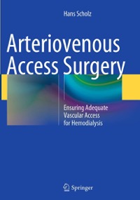 copertina di Arteriovenous Access Surgery . Ensuring Adequate Vascular Access for Hemodialysis