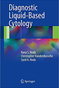 copertina di Diagnostic Liquid - Based Cytology