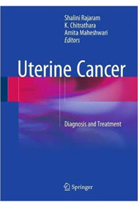 copertina di Uterine Cancer - Diagnosis and Treatment