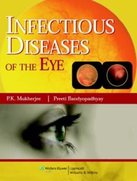 copertina di Infectious diseases of the Eyes