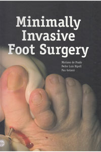 copertina di Minimally invasive foot surgery ( DVD included )