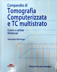 copertina di Compendio di tomografia computerizzata e TC multistrato - Cranio, rachide, dentascan
