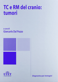 copertina di TC ( Tomografia computerizzata ) e RM ( Risonanza magnetica ) del cranio : tumori