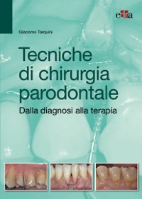 copertina di Tecniche di chirurgia parodontale - Dalla diagnosi alla terapia