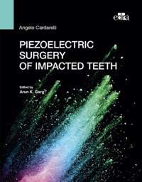 copertina di Piezoelectric surgery of impacted teeth