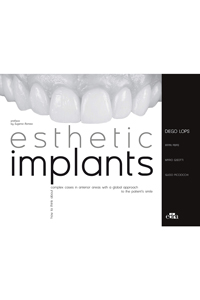 copertina di Esthetic implants. How to think about complex cases in anterior areas with a global ...