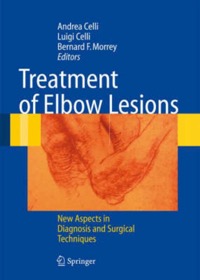 copertina di Treatment of Elbow Lesions - New aspects in diagnosis and surgical techniques