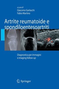 copertina di Artrite reumatoide e spondiloentesoartriti - Diagnostica per immagini ed imaging ...