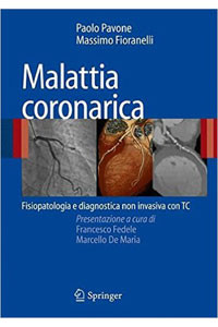 copertina di Malattia Coronarica - Fisiopatologia e diagnostica non invasiva con TC ( Tomografia ...