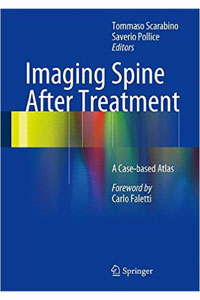 copertina di Imaging Spine After Treatment - A Case - based Atlas