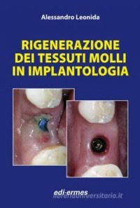 copertina di Rigenerazione dei tessuti molli in implantologia