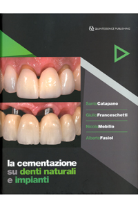copertina di La cementazione su denti naturali e impianti