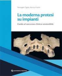 copertina di La moderna protesi su impianti - Guida al successo clinico sostenibile