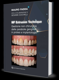 copertina di MF Extrusion Technique - Gestione non chirurgica delle parabole gengivali in protesi ...