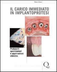 copertina di Il carico immediato in implantoprotesi - Protocoli sperimentali e applicazioni cliniche