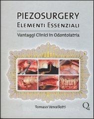 copertina di Piezosurgery - Elementi essenziali - Vantaggi clinici in odontoiatria