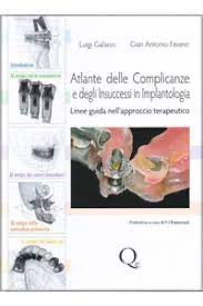 copertina di Atlante delle Complicanze e degli Insuccessi in Implantologia - Linee Guida nell' ...