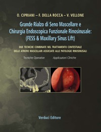 copertina di Grande Rialzo di Seno Mascellare e Chirurgia Endoscopica Funzionale Rinosinusale ...