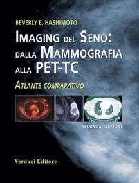 copertina di Imaging del Seno : dalla mammografia alla PET ( Tomografia ad emissione di positroni ...