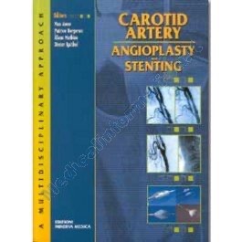 copertina di Carotid artery - Angioplasty and stenting