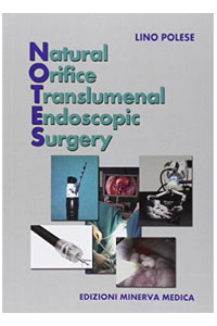 copertina di NOTES - Natural Orifice Translumenal Endoscopic Surgery
