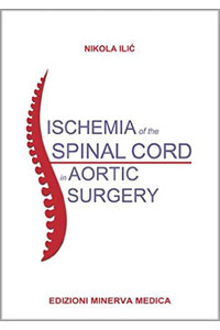 copertina di Ischemia of the spinal cord in aortic surgery