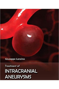 copertina di Treatment of intracranial aneurysms