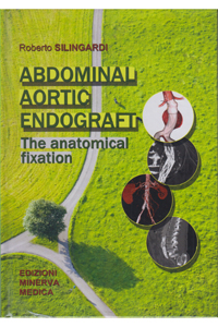 copertina di Abdominal aortic endograft - The anatomical fixation