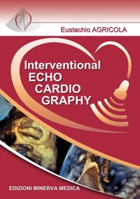 copertina di Interventional echocardiography