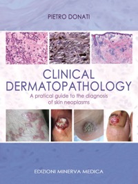 copertina di Clinical dermatopathology - A pratical guide to the diagnosis of skin neoplasms