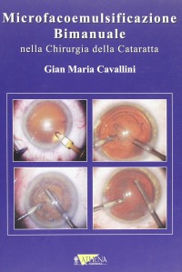 copertina di Microfacoemulsificazione bimanuale nella chirurgia della cataratta